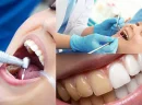 Düzce Diş Estetiği Gülüş Tasarımından Beyazlatmaya